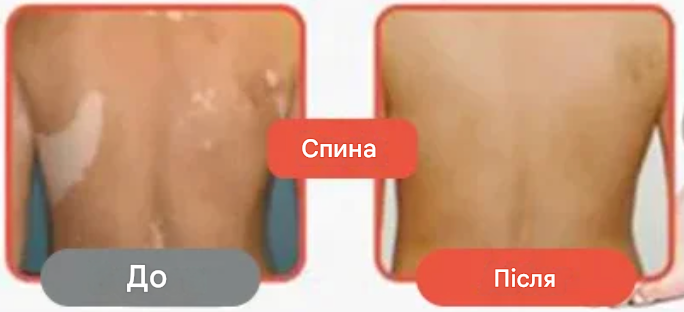 Baiyaolang — Трав’яний крем від свербіжу та шкірних проблем