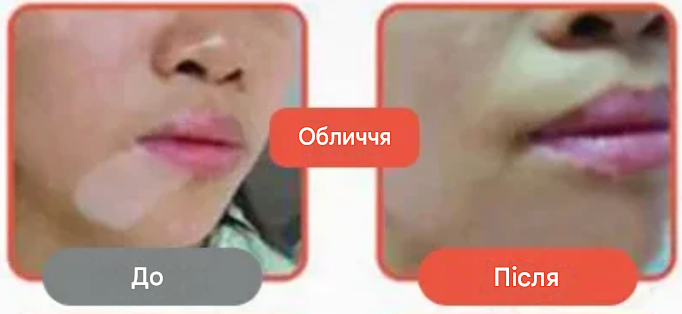 Baiyaolang — Трав’яний крем від свербіжу та шкірних проблем